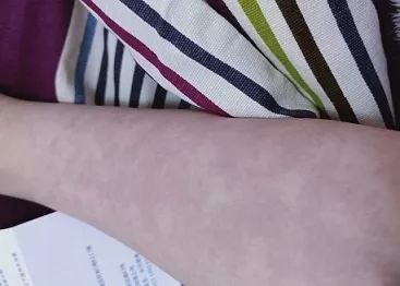 病毒感染比细菌感染更可怕?原来都和"这个因素"有关!