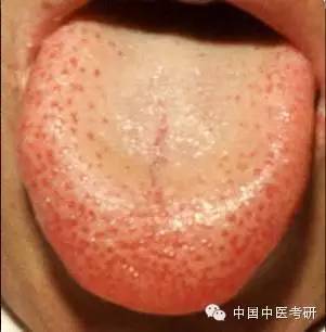 医学史上最全的舌诊图解!(价值珍藏版)