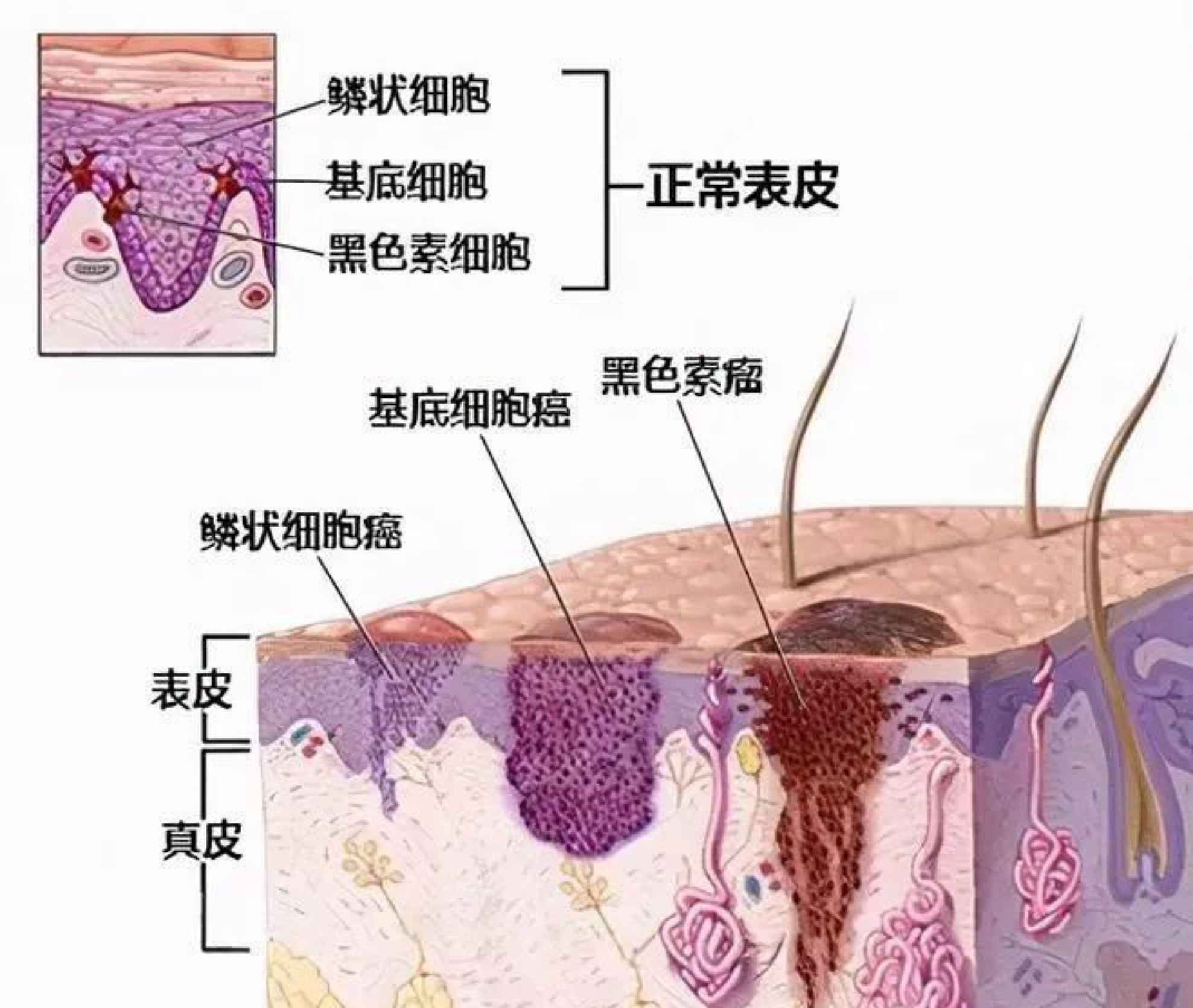 图片关键词